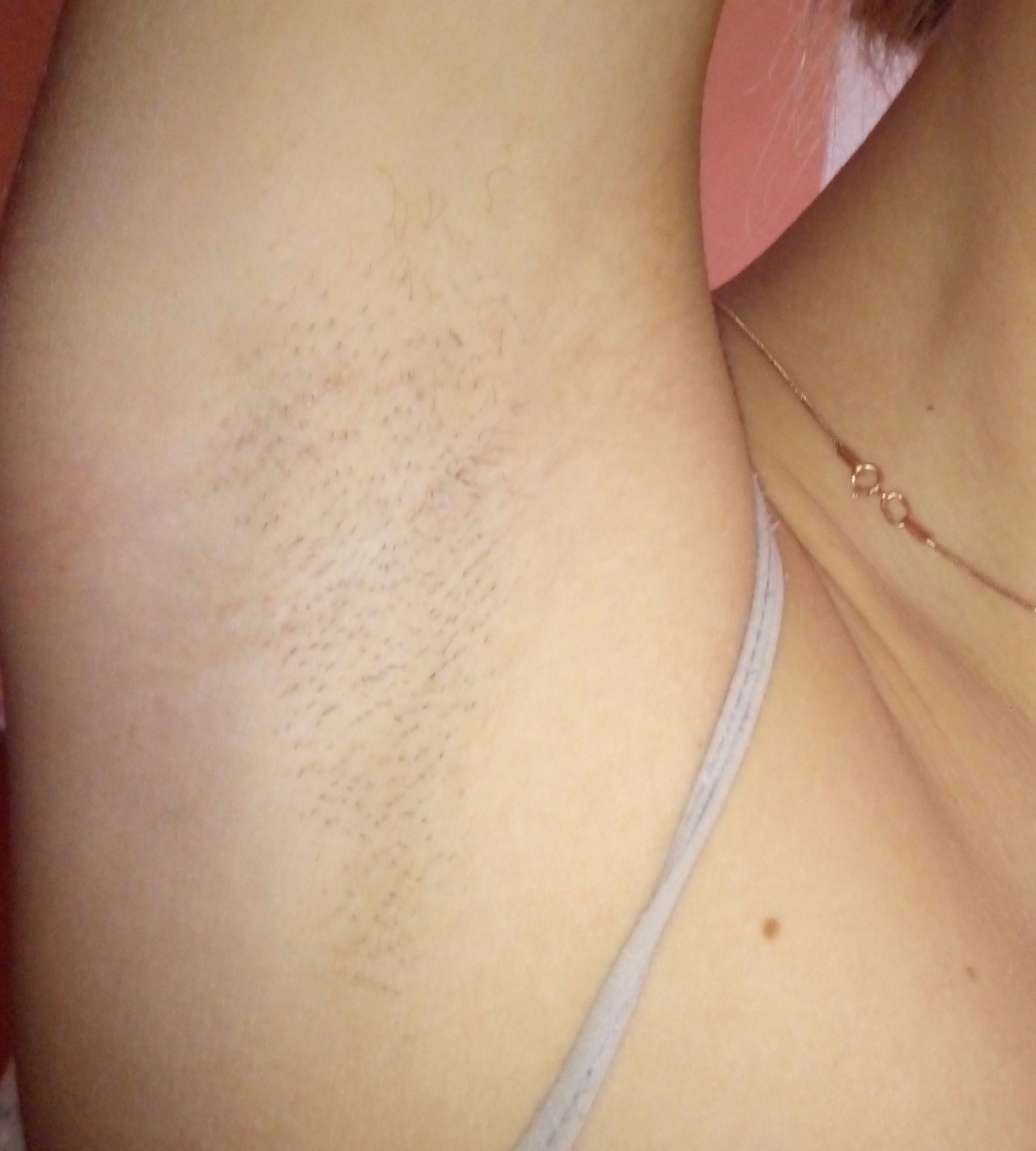 воспаление лимфоузлов на груди у женщин фото 97