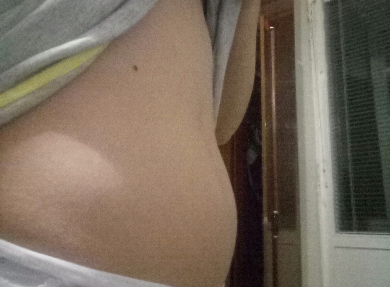 белые точки на груди при беременности фото 73