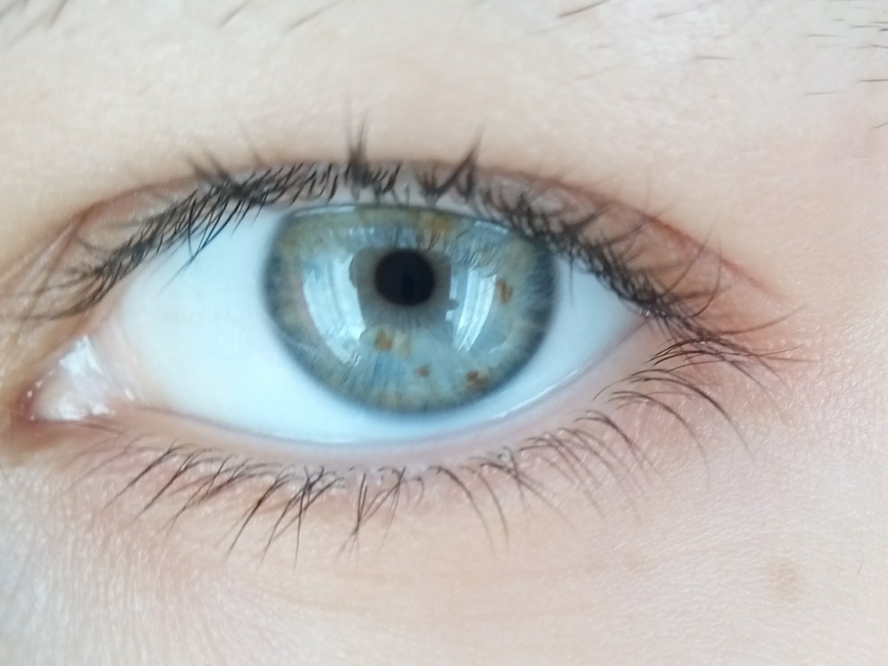 Желтые пятна на радужке глаза. Крапинки на радужной оболочки глазам. Голубые глаза с коричневым пятном.