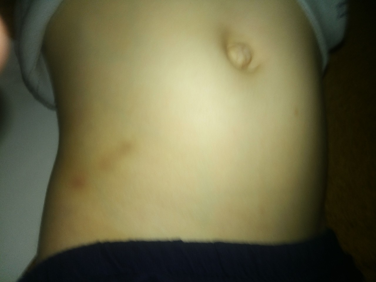 беременность сыпь на животе и груди фото 96