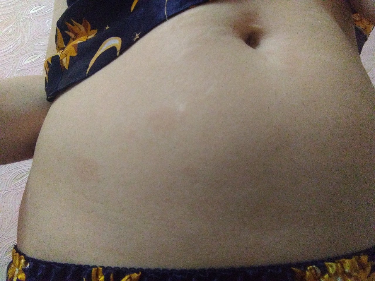 коричневые пятна на груди во время беременности фото 95