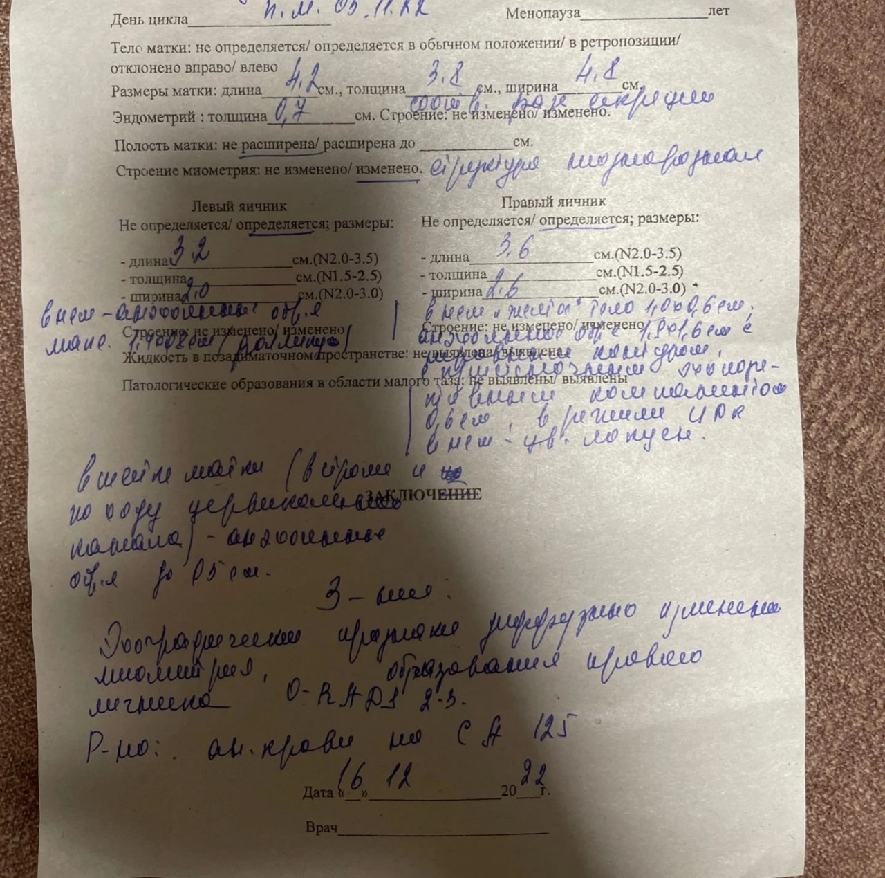 Скажите пожалуйста что бак уже готов xiaomi