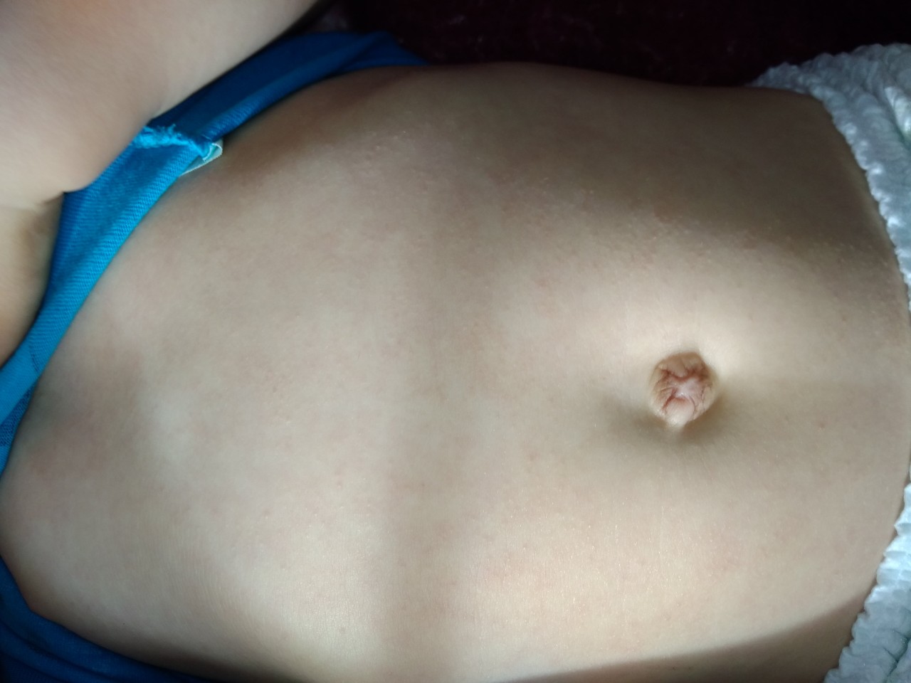 сыпь на спине и груди при беременности фото 115