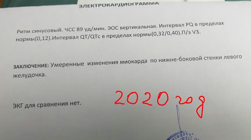 Заключение экг. Нормальное заключение ЭКГ. ЭКГ заключение норма. Заключение ЭКГ образец. Нормальное заключение ЭКГ У взрослых.