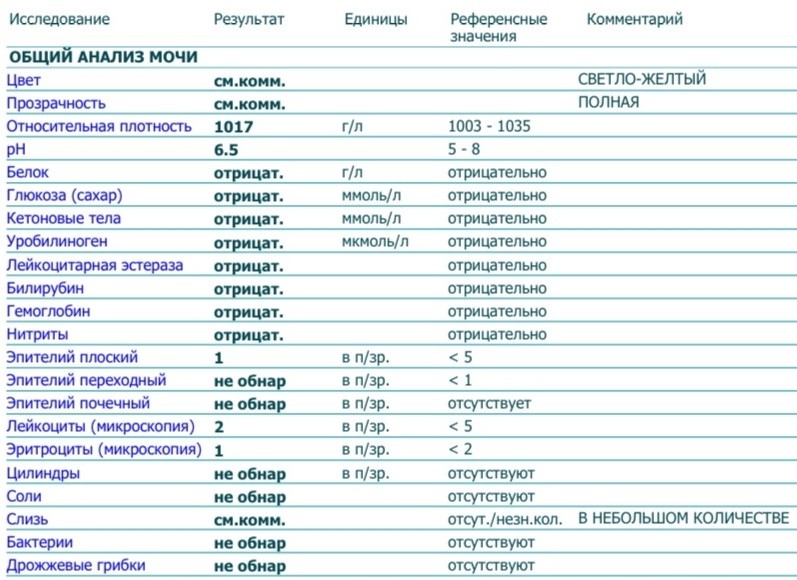 Hla b27 инвитро. HLA в27 анализ крови что это такое. Анализ HLA b27 что это за анализ. Анализ HLA b27 как расшифровать.