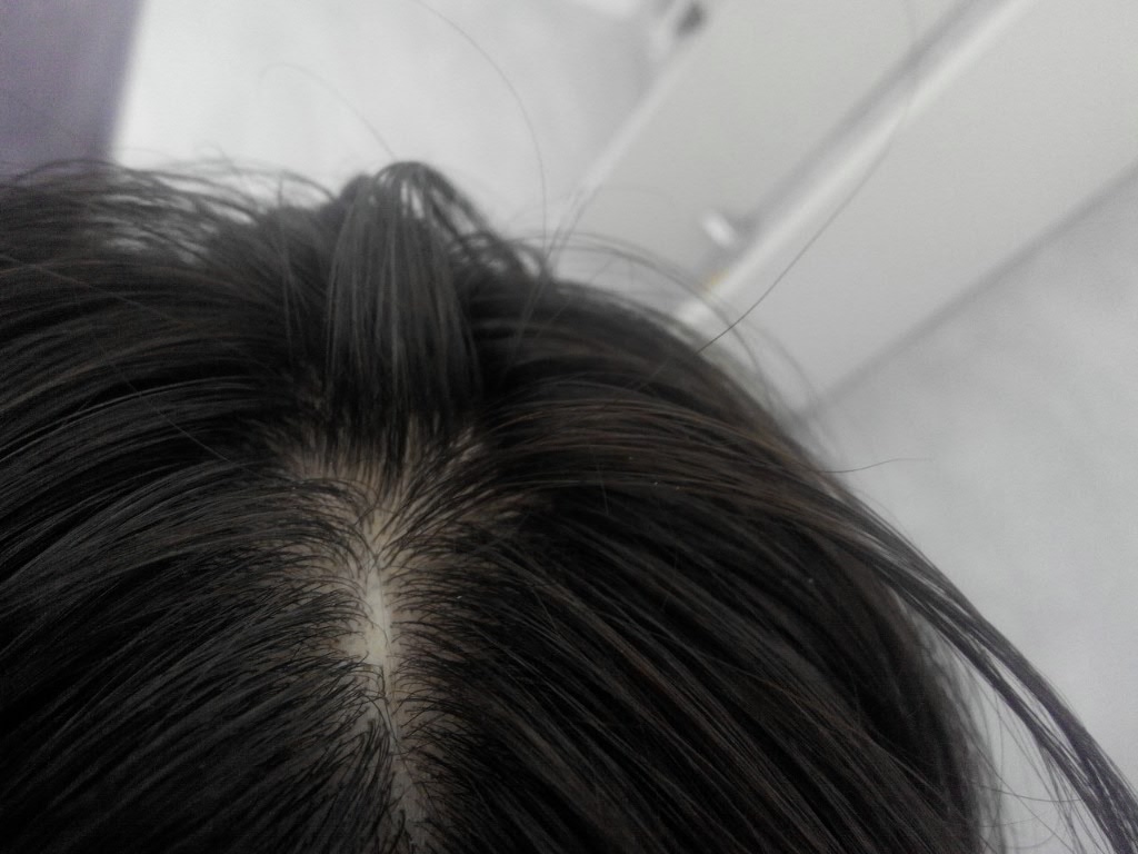 Волос на голове выпадают пучками. Приснилось что сильно выпадают волосы. К чему снится выпадение волос на голове у женщин.