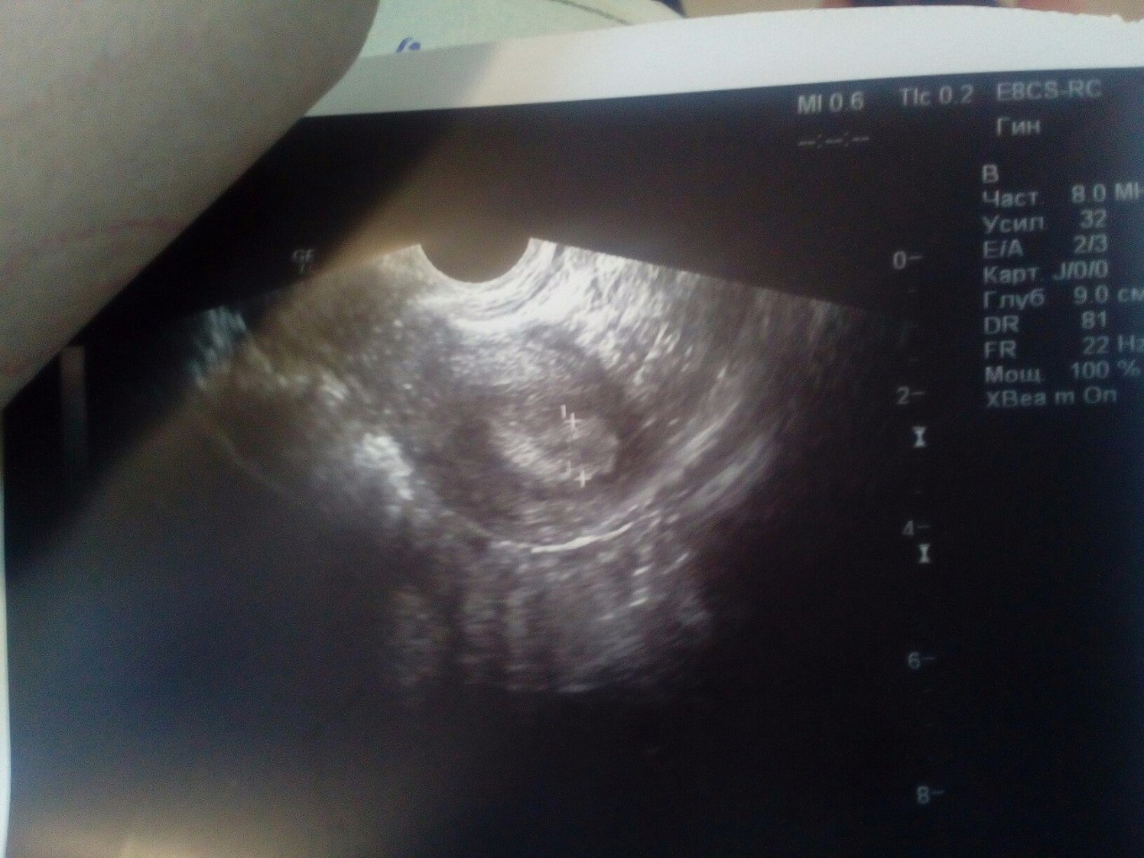 прозрачные выделения из одной груди при беременности фото 104