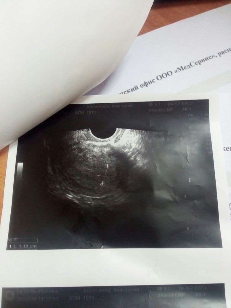 Узи 3 4 недели. Снимок УЗИ на 4 неделе беременности на мониторе. Снимки УЗИ беременности.