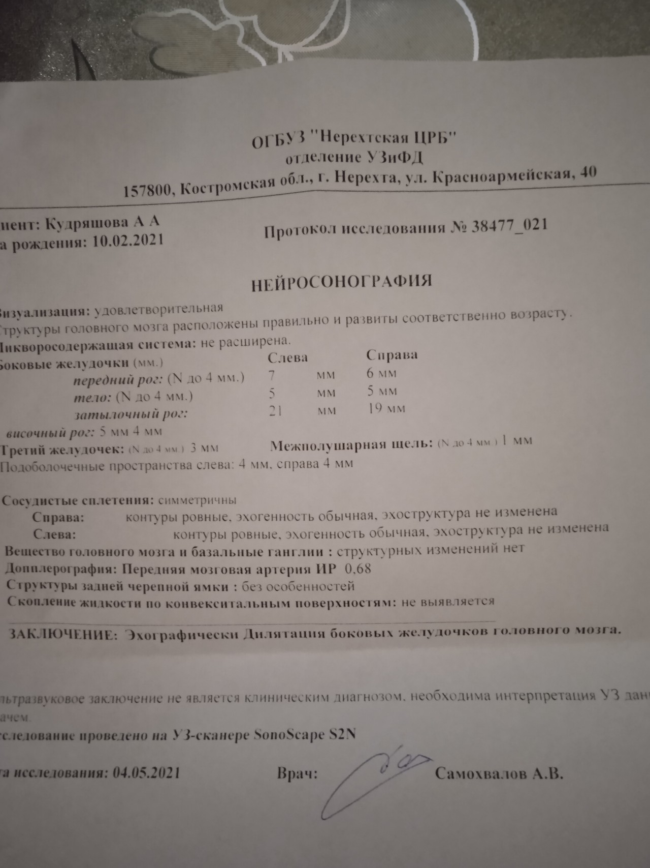 Таблица размеров желудочков головного мозга плода. Индекс боковых желудочков мрт. Индекс боковых желудочков.