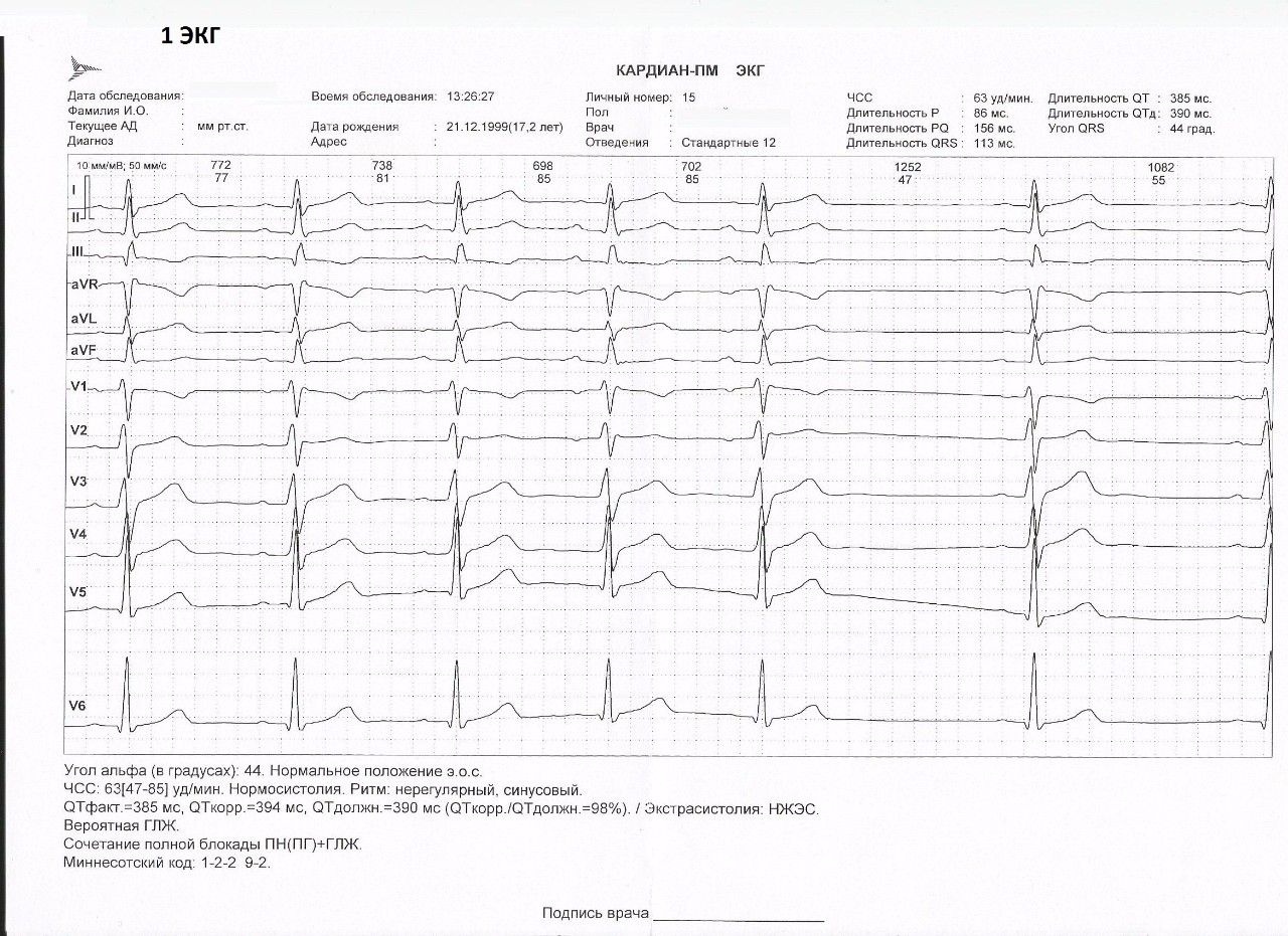 Как проходит экг. Прохождение медкомиссии что такое ЭКГ. Миннесотский код ЭКГ. Гипертрофия левого желудочка. Что такое Миннесотский код в кардиограмме.