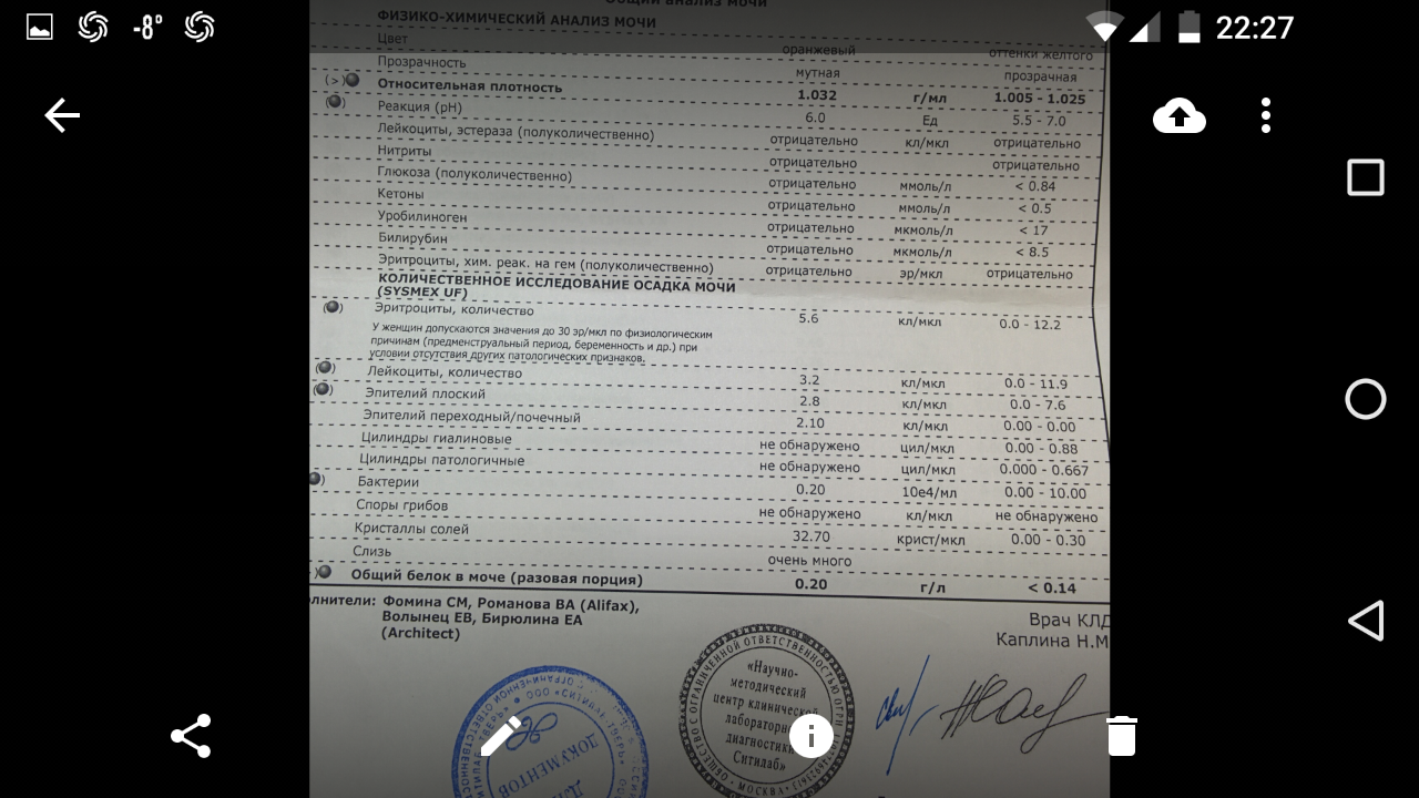 Белок в моче много что значит. Белок в моче 0.3 г/л. Общий белок в моче 0.3. 0 033 Белок в моче. Белок в моче 0 033 у женщины.