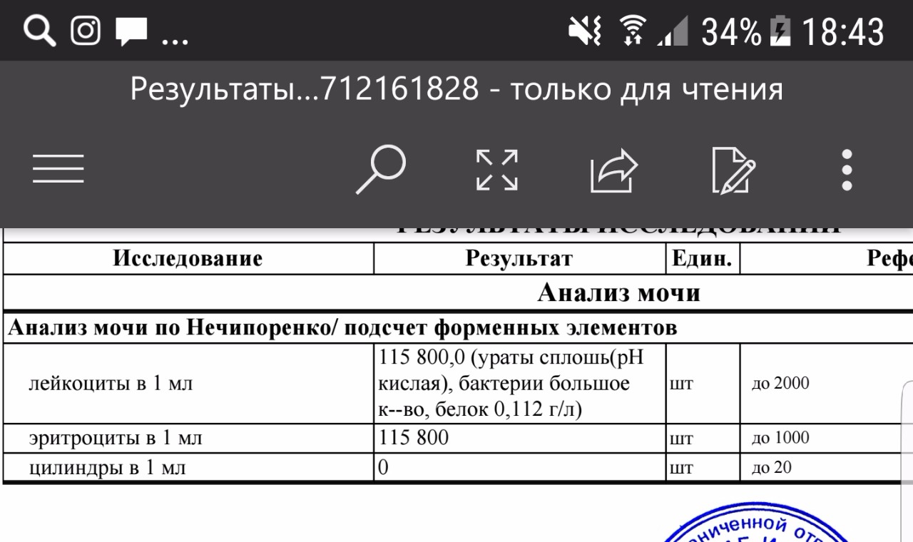 Анализ по нечипоренко норма у женщин. Исследование мочи методом Нечипоренко норма. Нечипоренко подсчет форменных элементов. Анализ мочи по Нечипоренко интерпретация результатов. Подсчет форменных элементов в моче.