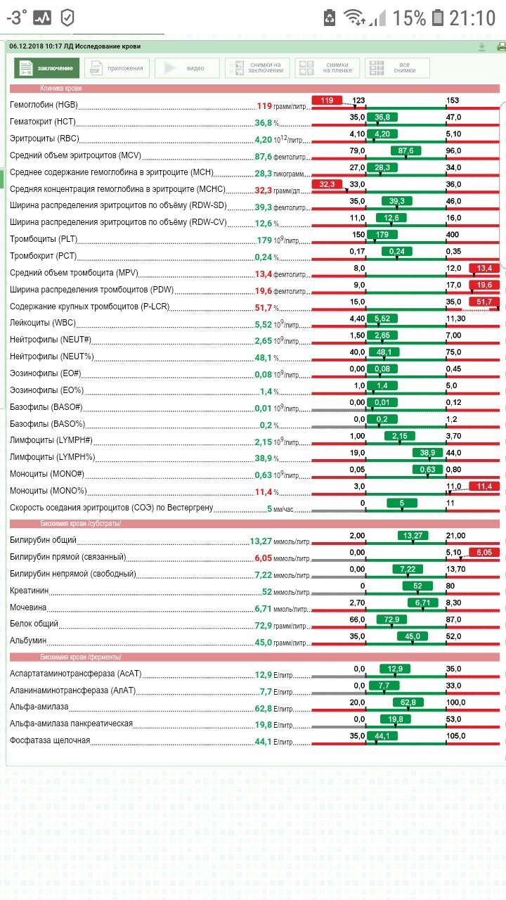 Повышено крупный. Содержание крупных тромбоцитов p-LCR. Содержание крупных тромбоцитов норма. Содержание крупных тромбоцитов повышено. Крупные тромбоциты в крови.