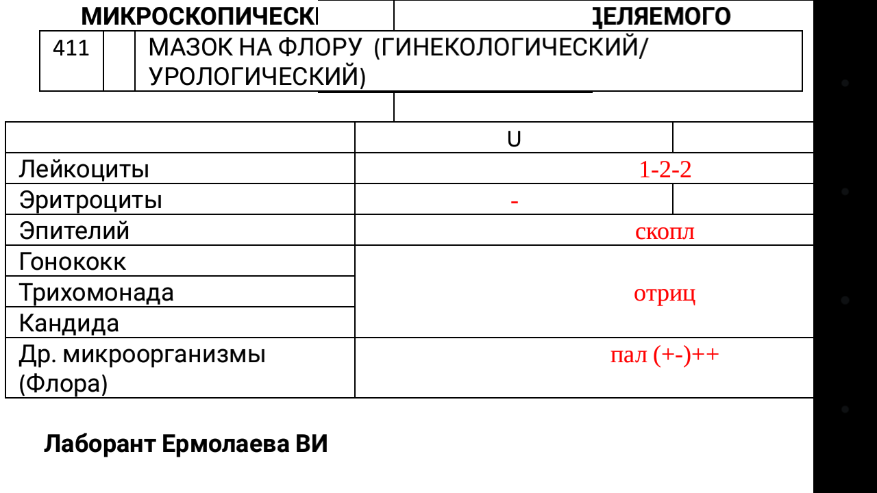 Атрофический мазок на цитологию что. Мазок на флору эпителий. Микроскопия мазка на флору. Атрофический Тип мазка норма.