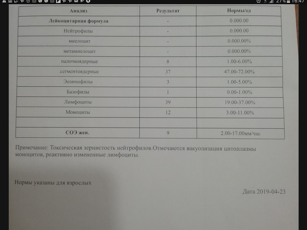 Анализ крови палочкоядерные норма. Обозначение нейтрофилов сегментоядерных в анализе крови. Палочкоядерные нейтрофилы в анализе крови что это такое. Сегментоядерные нейтрофилы обозначение в анализе.