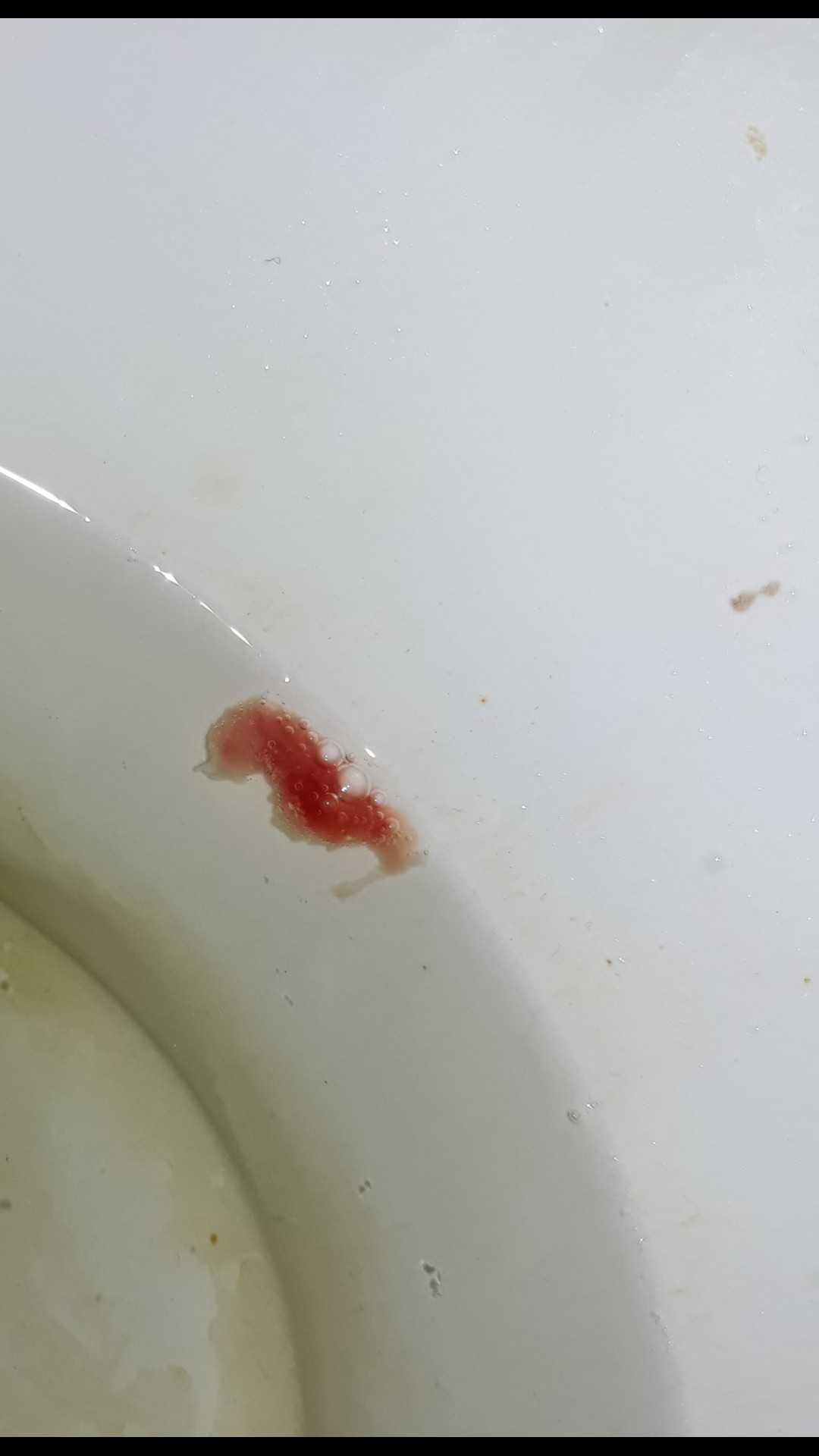 кровь из члена один сгусток фото 12