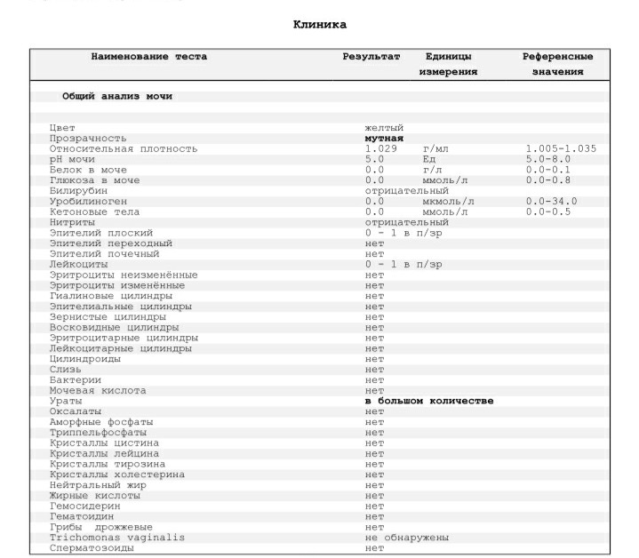 Уробилиноген норма у женщин. Единицы измерения уробилиногена в моче. Цилиндры в анализе мочи. Общий анализ мочи цилиндры. Уробилиноген в анализе мочи.