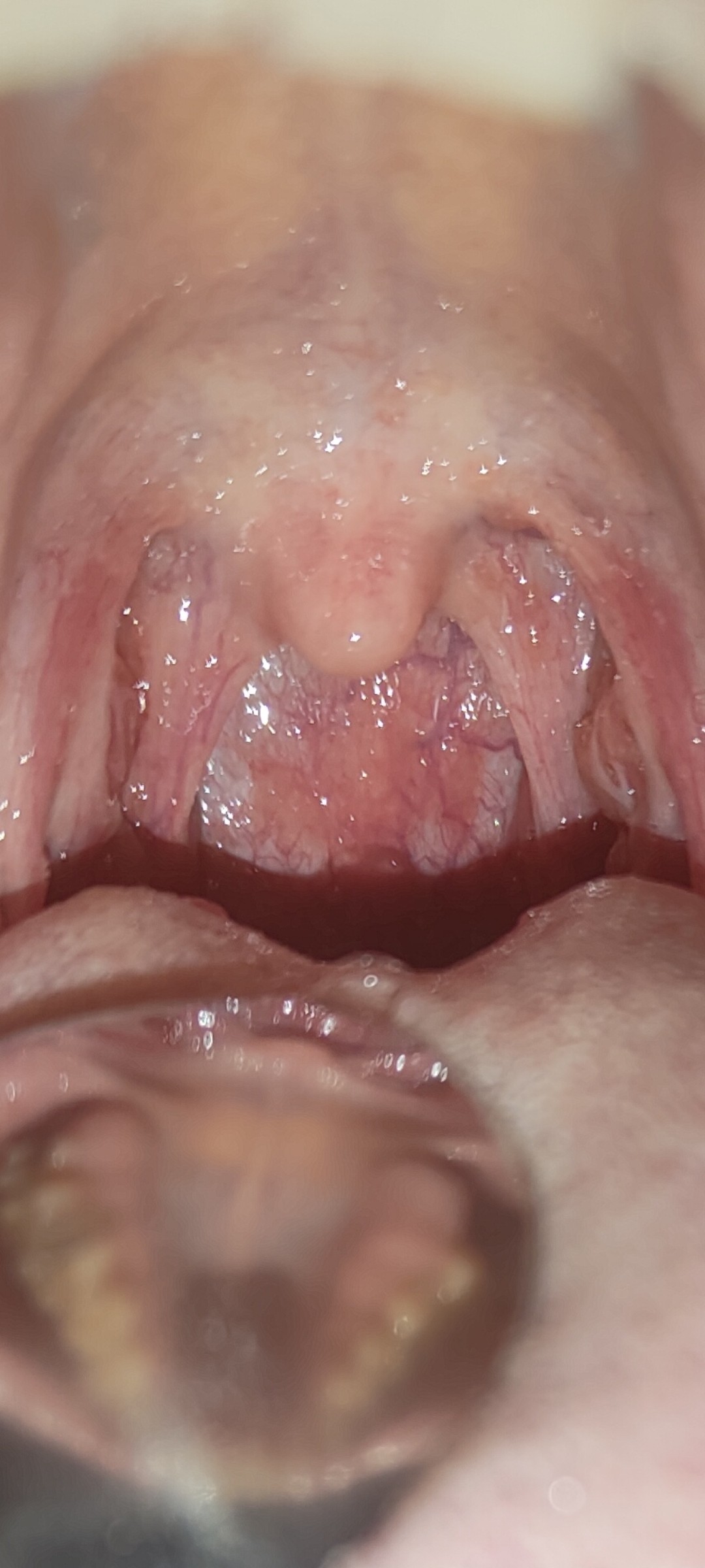 можно ли вылечить горло спермой фото 5