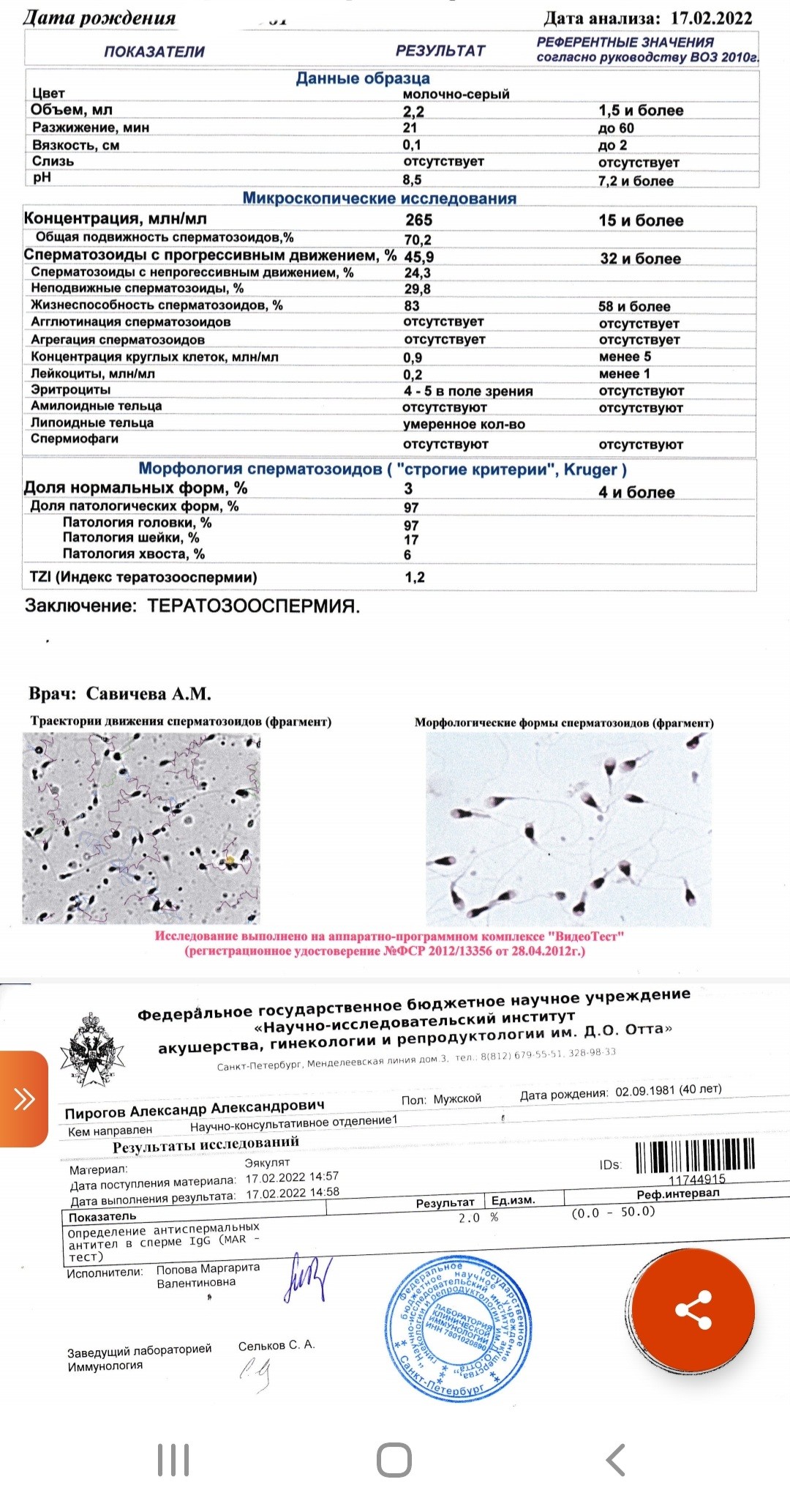 Тератозооспермия схема лечения