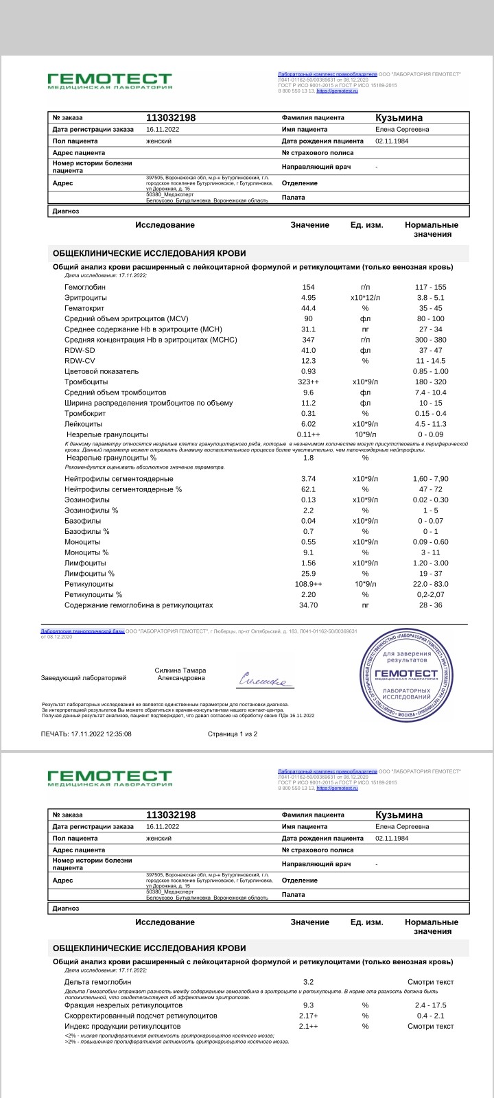 Ретикулоциты повышены