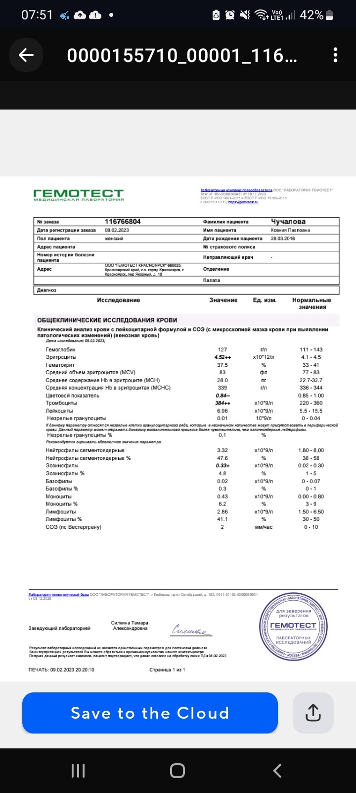 Анализ стула на скрытую кровь