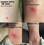 2 одинаковых укуса от насекомого фото 1