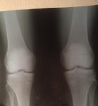 Боль и онемение левой ноги фото 1