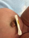 Заживающий пупок у новорожденного фото 1