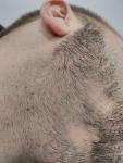 Белый клок волос на бороде фото 2