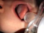 Кандидоз полости рта у младенца фото 3