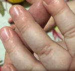 Сыпь на руках у ребёнка фото 3