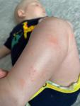 Шершавые красные пятна на ногах у ребёнка фото 2