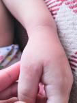 Высыпания на руках у ребенка фото 1