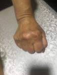 Артрит или артроз рук и ног фото 1