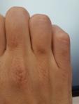 Потемнение кожи на трёх пальцах руки фото 1