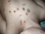 Красные пятна, похоже на болячку фото 1