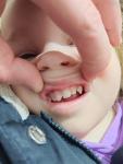 У моей дочери сломался молочный зуб фото 1