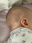 Твердая шишка на голове у ребёнка 6 месяцев фото 1