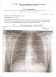 Определить заболевание по рентгену легких онлайн фото 1