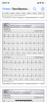 Помогите расшифровать холтер мониторинг фото 5