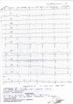 Все ли в порядке в кардиограмме? фото 1