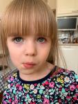 Воспаление глаза у ребёнка 4 лет фото 1