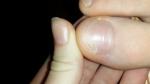 Проблемы с ногтями фото 1
