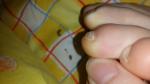Проблемы с ногтями фото 4