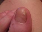 Не понятно что произошло с моим ногтем фото 1