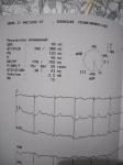 ЭКГ в норме? фото 1