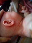 Выступила сыпь на сгибах у ребенка в 6 месяцев фото 1