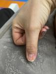 Странная деформация ногтя фото 1