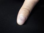 Травма пальца фото 1