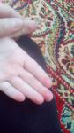 Сухие, облезающие пальцы у ребенка фото 1
